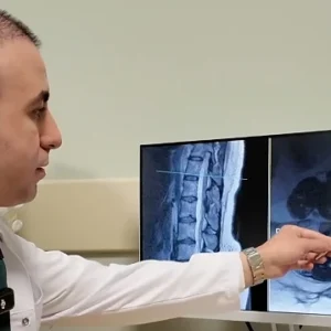 Bel Fıtığı Hakkında Önemli Bilgiler: Ameliyat Son Çare Olmalı